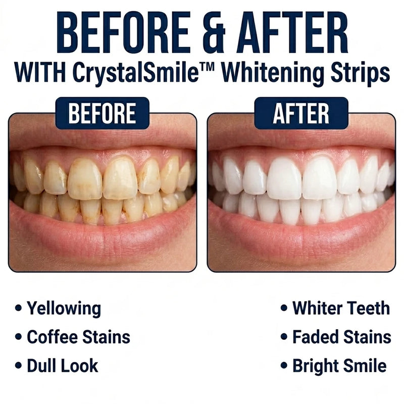 1+1 GRATIS HEUTE | CrystalSmile™ - Zahnaufhellungsstreifen