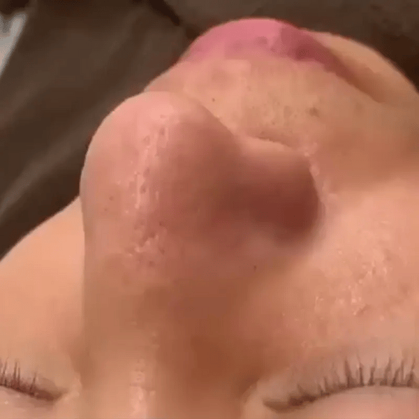 50% OFF TEMPORÄR  DermaVeo™