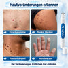 50% RABATT NUR HEUTE | TagFade™ - Strahlende, makellose Haut
