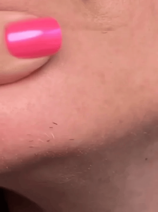 50% RABATT NUR HEUTE  FuzzFree™ - 2-in-1 Gesichtshaarentferner