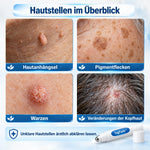 50% RABATT NUR HEUTE | TagFade™ - Strahlende, makellose Haut