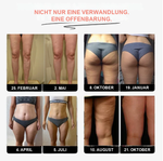 50% RABATT NUR HEUTE | SleekLegs™ - 3D-Leggings