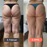 50% RABATT NUR HEUTE | SleekLegs™ - 3D-Leggings