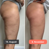 50% RABATT NUR HEUTE | SleekLegs™ - 3D-Leggings