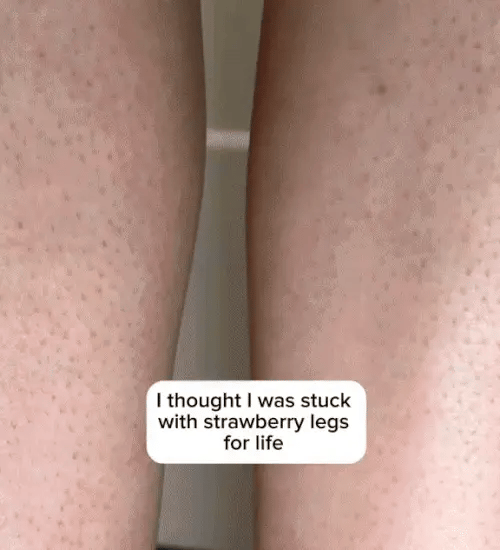 1 + 1 GRATIS HEUTE  DermaBare™ 