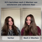 50% RABATT NUR HEUTE | SoftRain™ - Duschkopf mit Filter