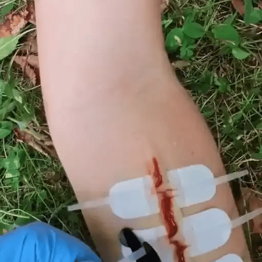 50% RABATT NUR HEUTE  WoundZip™ - Notfall-Wundverschluss-Set