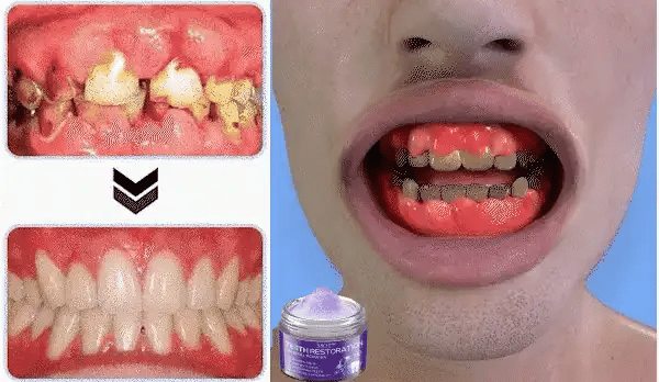 1 + 1 GRATIS HEUTE  DentiGlow™