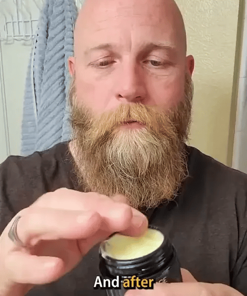1+1 GRATIS HEUTE  ForgeDerm™ - Talg-Balsam