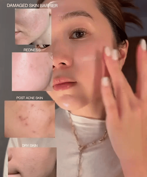 1+1 GRATIS HEUTE  FirmRevive™ - Tiefenreparierende Anti-Falten-Creme